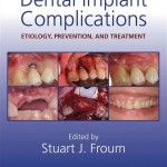 Dental Implant Complications Etiology, Prevention and Treatment