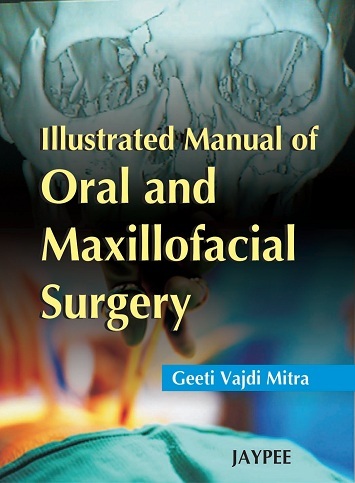 Illustrated manual of oral and maxillofacial surgery