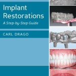 Implant Restorations: A Step-by-Step Guide, 2nd Edition