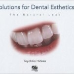 Solutions for Dental Esthetics: The Natural Look