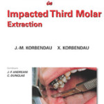 Clinical Success in Impacted Third Molar Extraction