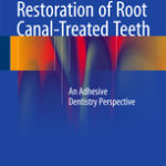Restoration of Root Canal-Treated Teeth                            :An Adhesive Dentistry Perspective