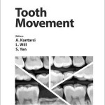 Tooth Movement