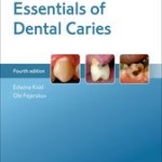 Essentials of Dental Caries, 4th Edition