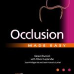 Occlusion Made Easy