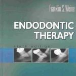 Endodontic Therapy