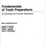 Fundamentals of Tooth Preparations : For Cast Metal and Porcelain Restorations