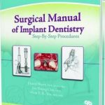 Surgical Manual of Implant Dentistry : Step-by-step Procedures