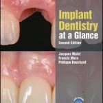 Implant Dentistry at a Glance 2nd Edition