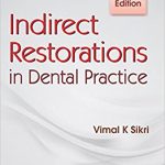 Indirect Restorations in Dental Practice