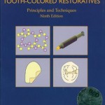 Tooth-Colored Restoratives: Principles and Techniques
