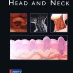 Cancer of the  Head and Neck