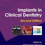 Implants in Clinical Dentistry, 2nd Edition