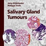 Salivary Gland Tumours: Monographs in Clinical Cytology