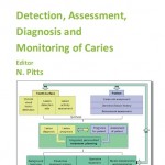 Detection, Assessment, Diagnosis and Monitoring of Caries