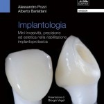 Implantologia: Mini-invasività, precisione ed estetica nella riabilitazione implantoprotesica