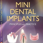 Mini Dental Implants: Principles and Practice
