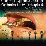 [Free] Clinical Applications of Orthodontic Mini-implants