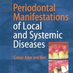 Periodontal Manifestations of Local and Systemic Diseases: Colour Atlas and Text