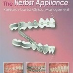 The Herbst Appliance: Research-Based Clinical Management