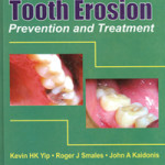 Tooth Erosion: Prevention and Treatment