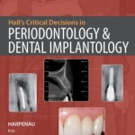 Hall’s Critical Decisions in Periodontology
