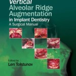 Vertical Alveolar Ridge Augmentation in Implant Dentistry : A Surgical Manual