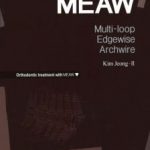 MEAW Multi-loop Edgewise Archwire