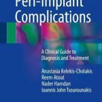 Peri-Implant Complications : A Clinical Guide to Diagnosis and Treatment