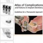 Atlas of Complications and Failures in Implant Dentistry : Guidelines for a Therapeutic Approach