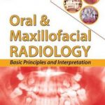 Oral & Maxillofacial Radiology : Basic Principles and Interpretation