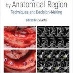 Bone Augmentation by Anatomical Region : Techniques and Decision-Making