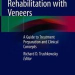 Esthetic Oral Rehabilitation with Veneers : A Guide to Treatment Preparation and Clinical Concepts