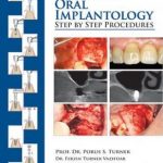 Clinical Guide to Oral Implantology : Step by Step Procedures