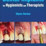 Dental Implants for Hygienists and Therapists