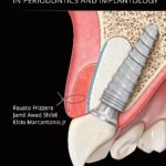 Integrated Esthetics in Periodontics and Implantology