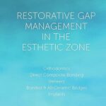 Restorative Gap Management in the Esthetic Zone: Orthodontics | Direct Composite Bonding | Veneers | Bonded & All-Ceramic Bridges | Implants