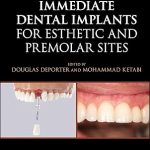 Immediate Dental Implants for Esthetic and Premolar Sites